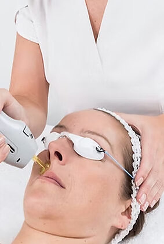 Séance de laser au cabinet, protection des yeux